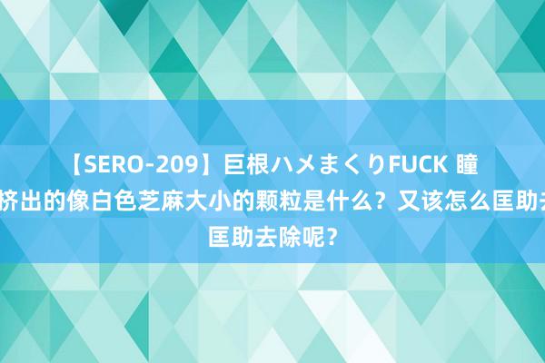 【SERO-209】巨根ハメまくりFUCK 瞳 鼻子上挤出的像白色芝麻大小的颗粒是什么？又该怎么匡助去除呢？